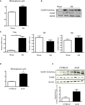 O-GlcNacylation Links TxNIP to Inflammasome Activation in Pancreatic β Cells